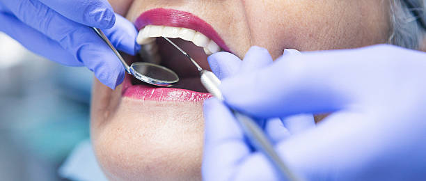 Best Emergency Tooth Extraction in Sunnyside, GA